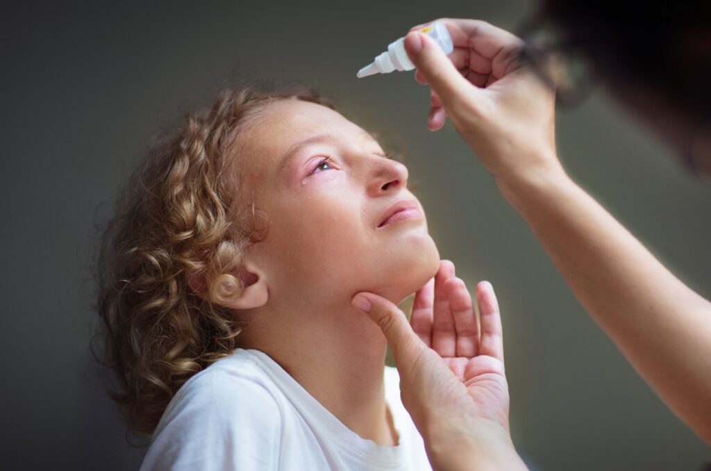 A child with an eye infection getting antibiotic eye drops placed in their eye.